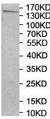 Western blot - Anti-Insulin Receptor antibody (AB206849)