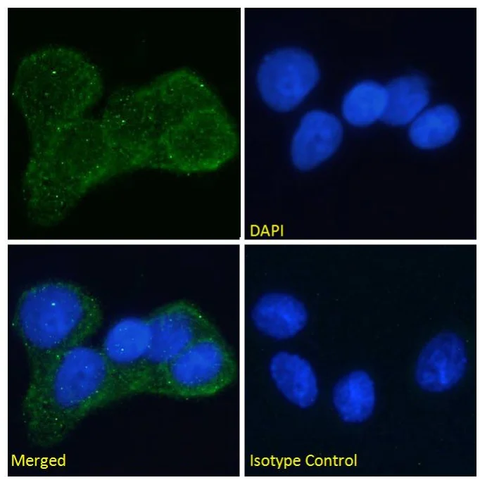 Immunocytochemistry/ Immunofluorescence - Anti-Insulin Receptor antibody [Fab 83-7] (AB245688)