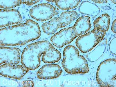 Immunohistochemistry (Formalin/PFA-fixed paraffin-embedded sections) - Anti-Insulin Receptor beta antibody [C18C4] (AB69508)