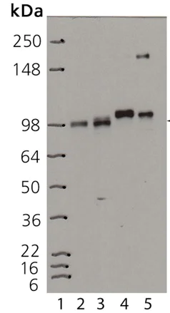 Western blot - Anti-Insulin Receptor beta antibody [C18C4] (AB69508)