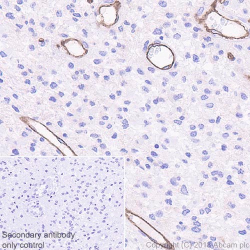 Immunohistochemistry (Formalin/PFA-fixed paraffin-embedded sections) - Anti-Insulin Receptor beta antibody [EPR22167] (AB227831), expandable thumbnail