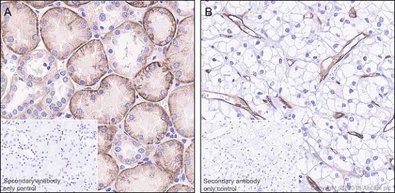 Immunohistochemistry (Formalin/PFA-fixed paraffin-embedded sections) - Anti-Insulin Receptor beta antibody [EPR22167] (AB227831), expandable thumbnail