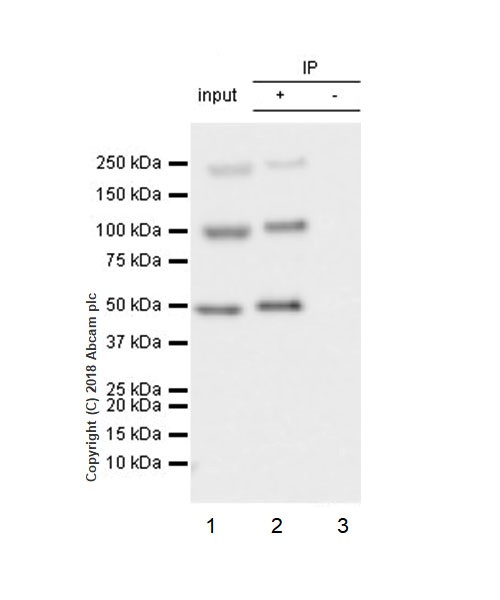 Immunoprecipitation - Anti-Insulin Receptor beta antibody [EPR22167] (AB227831), expandable thumbnail