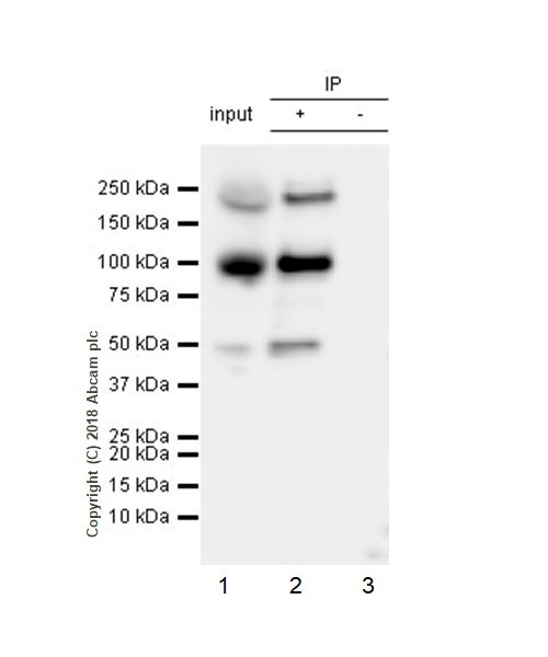 Immunoprecipitation - Anti-Insulin Receptor beta antibody [EPR22167] (AB227831), expandable thumbnail