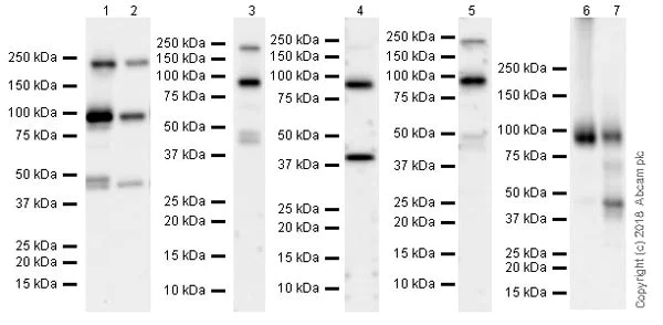 Western blot - Anti-Insulin Receptor beta antibody [EPR22167] (AB227831)