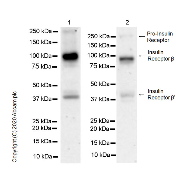 Western blot - Anti-Insulin Receptor beta antibody [EPR23566-103] - BSA and Azide free (ab278104), expandable thumbnail