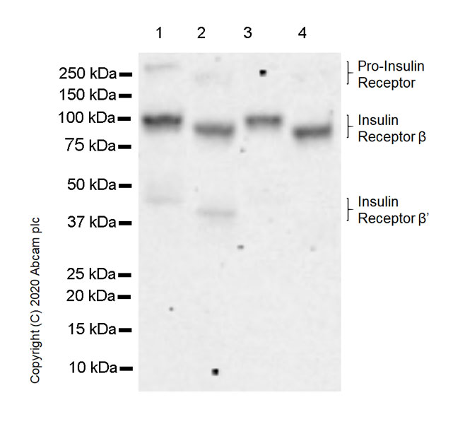 Western blot - Anti-Insulin Receptor beta antibody [EPR23566-103] - BSA and Azide free (AB278104), expandable thumbnail