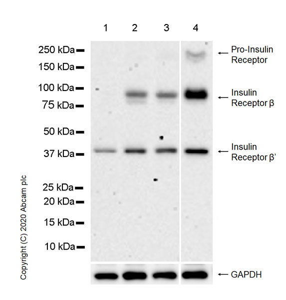 Western blot - Anti-Insulin Receptor beta antibody [EPR23566-103] - BSA and Azide free (AB278104), expandable thumbnail