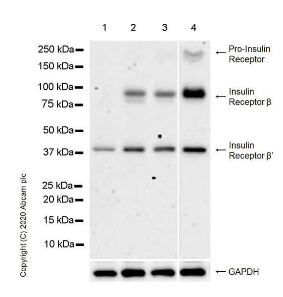 Western blot - Anti-Insulin Receptor beta antibody [EPR23566-103] - BSA and Azide free (AB278104)