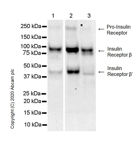 Western blot - Anti-Insulin Receptor beta antibody [EPR23566-103] - BSA and Azide free (ab278104), expandable thumbnail
