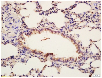 Immunohistochemistry (Formalin/PFA-fixed paraffin-embedded sections) - Anti-Insulin Receptor beta (phospho Y1185) antibody (AB203278)