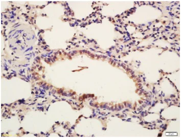 Immunohistochemistry (Formalin/PFA-fixed paraffin-embedded sections) - Anti-Insulin Receptor beta (phospho Y1185) antibody (AB203278)