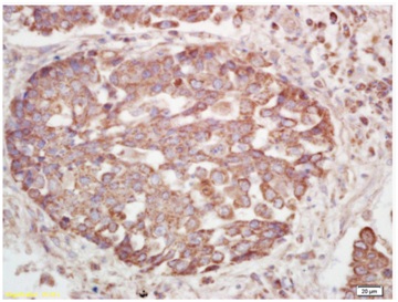 Immunohistochemistry (Formalin/PFA-fixed paraffin-embedded sections) - Anti-Insulin Receptor beta (phospho Y1185) antibody (AB203278)