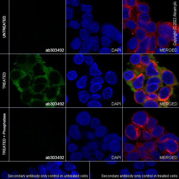 Immunocytochemistry/ Immunofluorescence - Anti-Insulin Receptor beta (phospho Y1361) antibody [EPR26130-37] (AB303492)