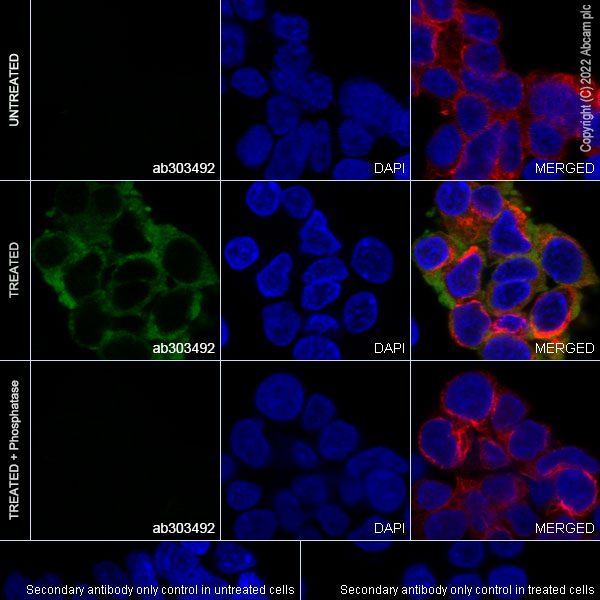 Immunocytochemistry/ Immunofluorescence - Anti-Insulin Receptor beta (phospho Y1361) antibody [EPR26130-37] - BSA and Azide free (AB303493), expandable thumbnail