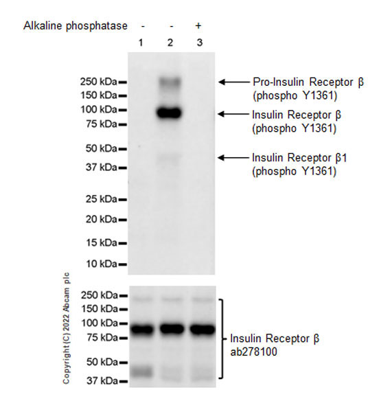 Western blot - Anti-Insulin Receptor beta (phospho Y1361) antibody [EPR26130-37] - BSA and Azide free (ab303493), expandable thumbnail