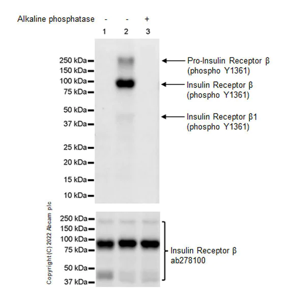 Western blot - Anti-Insulin Receptor beta (phospho Y1361) antibody [EPR26130-37] - BSA and Azide free (AB303493)