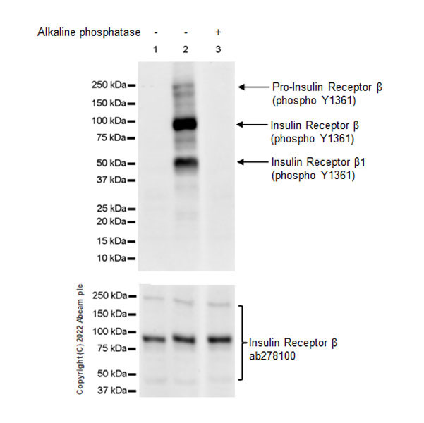 Western blot - Anti-Insulin Receptor beta (phospho Y1361) antibody [EPR26130-37] - BSA and Azide free (ab303493), expandable thumbnail
