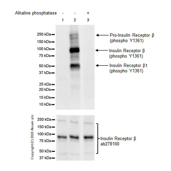 Western blot - Anti-Insulin Receptor beta (phospho Y1361) antibody [EPR26130-37] - BSA and Azide free (AB303493)