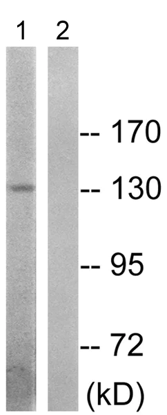 Western blot - Anti-Insulin Receptor (phospho T1375) antibody (AB192657)
