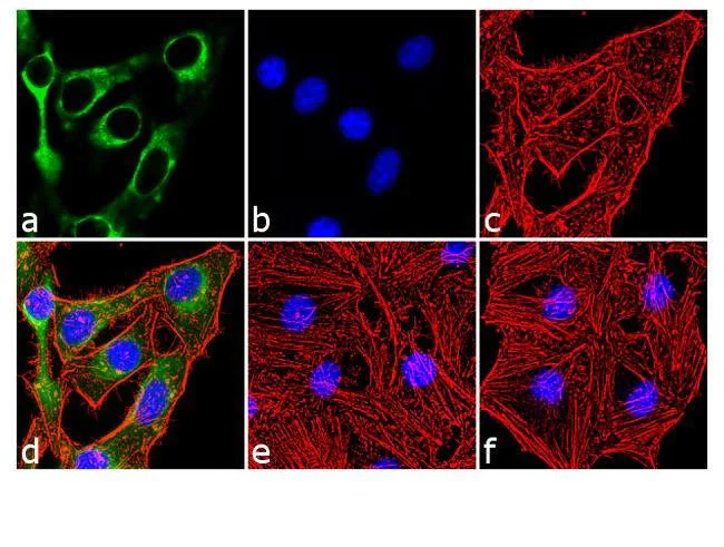 Immunocytochemistry - Anti-Insulin Receptor (phospho Y1158) antibody [8HCLC] (AB277763)
