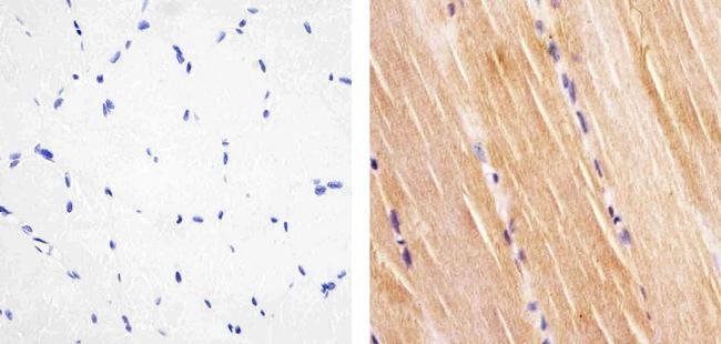 Immunohistochemistry (Formalin/PFA-fixed paraffin-embedded sections) - Anti-Insulin Receptor (phospho Y1158) antibody [8HCLC] (AB277763)