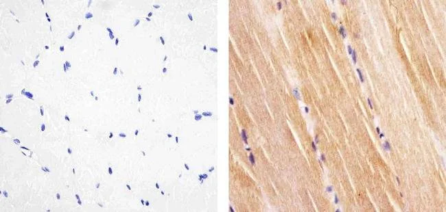 Immunohistochemistry (Formalin/PFA-fixed paraffin-embedded sections) - Anti-Insulin Receptor (phospho Y1158) antibody [8HCLC] (AB277763)
