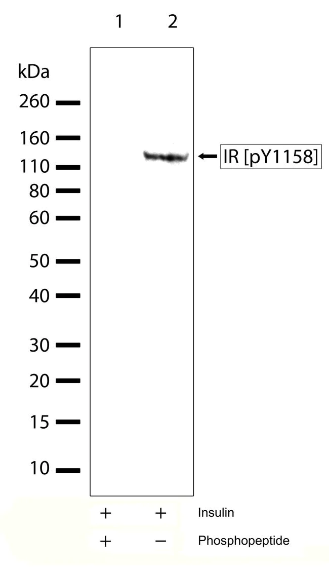 Western blot - Anti-Insulin Receptor (phospho Y1158) antibody [8HCLC] (AB277763)
