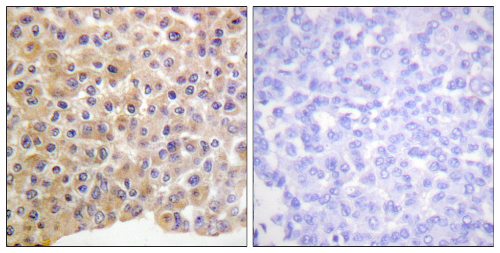 Immunohistochemistry (Formalin/PFA-fixed paraffin-embedded sections) - Anti-Insulin Receptor (phospho Y1361) antibody (AB60946)