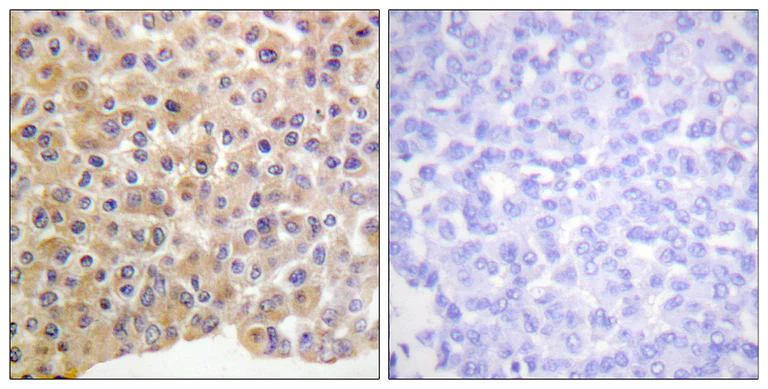 Immunohistochemistry (Formalin/PFA-fixed paraffin-embedded sections) - Anti-Insulin Receptor (phospho Y1361) antibody (AB60946)