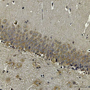 Immunohistochemistry (Formalin/PFA-fixed paraffin-embedded sections) - Anti-Insulin Receptor (phospho Y1361) antibody (AB60946)