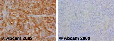 Immunohistochemistry (Formalin/PFA-fixed paraffin-embedded sections) - Anti-Insulin Receptor (phospho Y1361) antibody (AB60946)