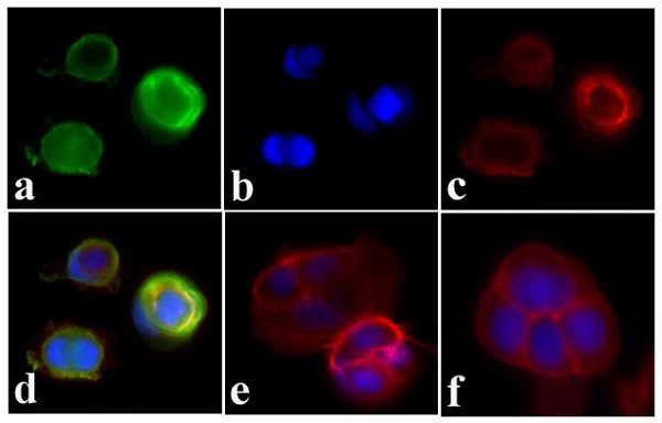 Immunocytochemistry/ Immunofluorescence - Anti-Insulin Receptor (phospho Y972) antibody (AB5678)
