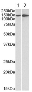 Western blot - Anti-Integrin alpha 1 antibody (AB200570), expandable thumbnail