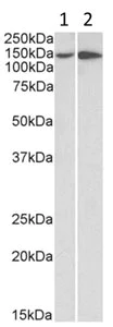 Western blot - Anti-Integrin alpha 1 antibody (AB200570)