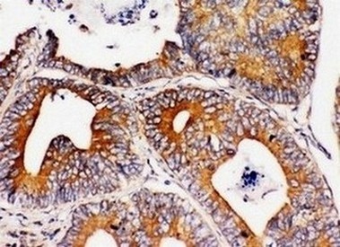 Immunohistochemistry (Formalin/PFA-fixed paraffin-embedded sections) - Anti-Integrin alpha 1 antibody - C-terminal (AB181434), expandable thumbnail