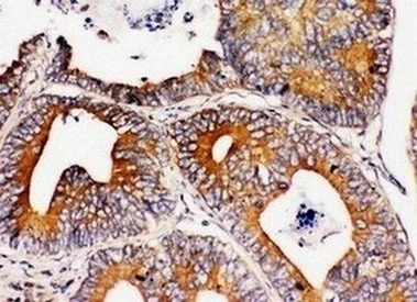 Immunohistochemistry (Formalin/PFA-fixed paraffin-embedded sections) - Anti-Integrin alpha 1 antibody - C-terminal (AB181434)