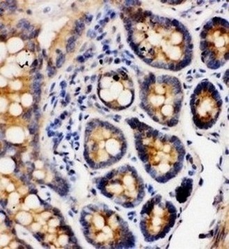 Immunohistochemistry (Formalin/PFA-fixed paraffin-embedded sections) - Anti-Integrin alpha 1 antibody - C-terminal (AB181434), expandable thumbnail