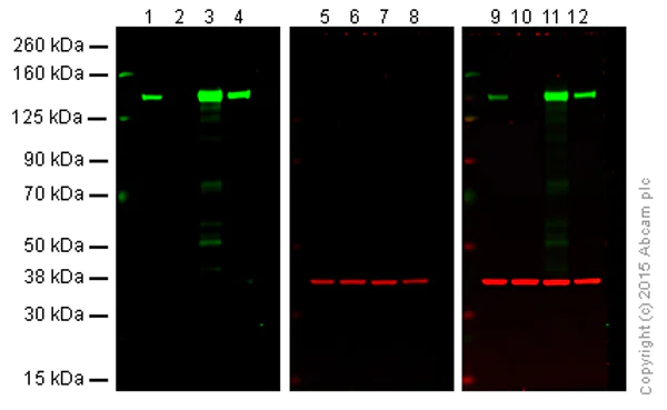 Western blot - Anti-Integrin alpha 2 antibody [EPR17338] - C-terminal (AB181548)
