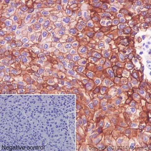Immunohistochemistry (Formalin/PFA-fixed paraffin-embedded sections) - Anti-Integrin alpha 2 antibody [EPR17338] - Low endotoxin, Azide free (AB222377)