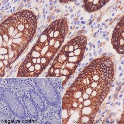 Immunohistochemistry (Formalin/PFA-fixed paraffin-embedded sections) - Anti-Integrin alpha 2 antibody [EPR17338] - Low endotoxin, Azide free (AB222377)