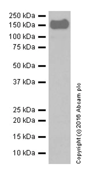 Western blot - Anti-Integrin alpha 2 antibody [EPR17349] (AB181549)