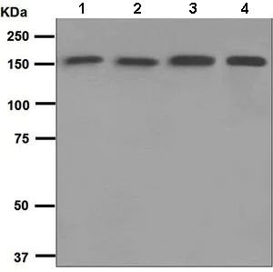Western blot - Anti-Integrin alpha 2 antibody [EPR5788] (AB133557)