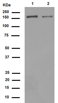 Western blot - Anti-Integrin alpha 2 antibody [EPR5788] (AB133557), expandable thumbnail