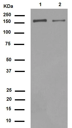Western blot - Anti-Integrin alpha 2 antibody [EPR5788] (AB133557)