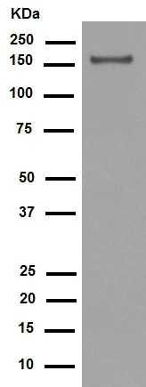 Western blot - Anti-Integrin alpha 2 antibody [EPR5788] (AB133557)