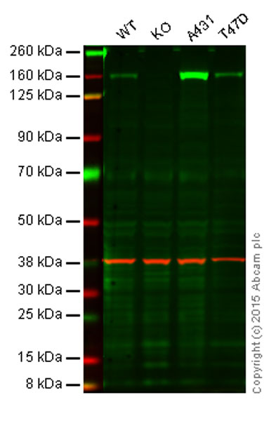 Western blot - Anti-Integrin alpha 2 antibody [EPR5788] (AB133557), expandable thumbnail