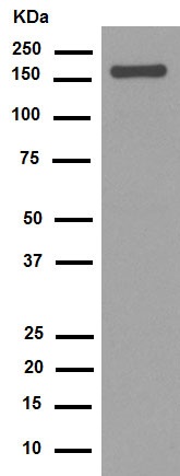 Western blot - Anti-Integrin alpha 2 antibody [EPR5788] (AB133557), expandable thumbnail