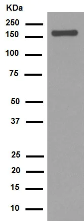 Western blot - Anti-Integrin alpha 2 antibody [EPR5788] (AB133557)