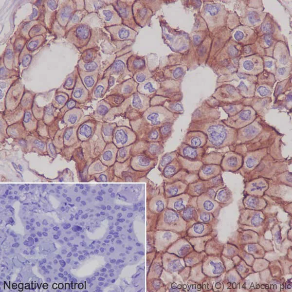 Immunohistochemistry (Formalin/PFA-fixed paraffin-embedded sections) - Anti-Integrin alpha 2 antibody [EPR5788] - Low endotoxin, Azide free (AB221214)